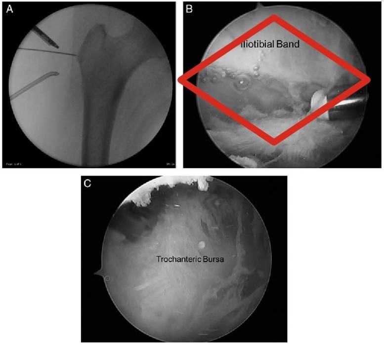 Arthroscopy pictures